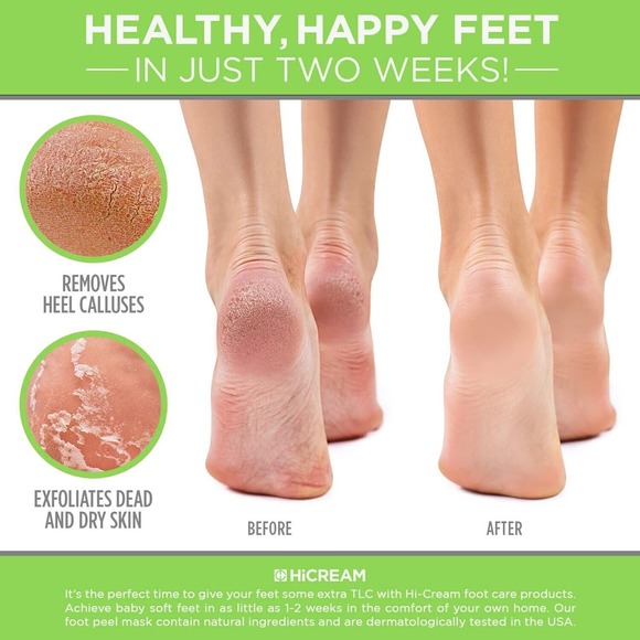 Foot Peel Mask- 2 Pairs of Regular Skin Exfoliating Foot mask For Cracked Heels - Picture 5 of 5